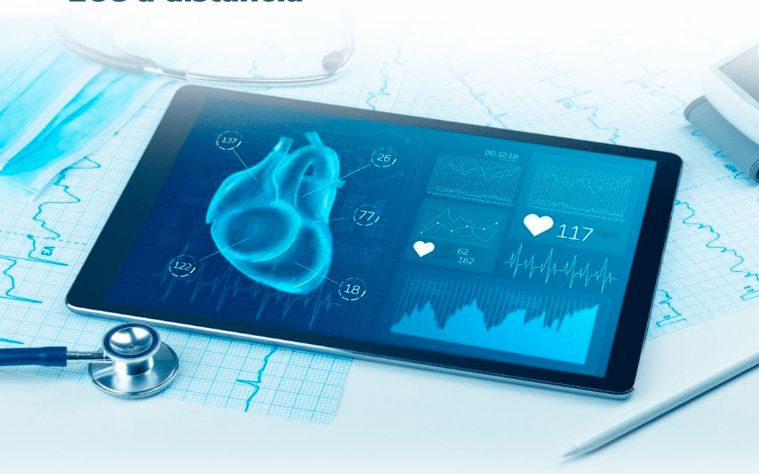 Tudo o que você precisa saber sobre ECG à distância